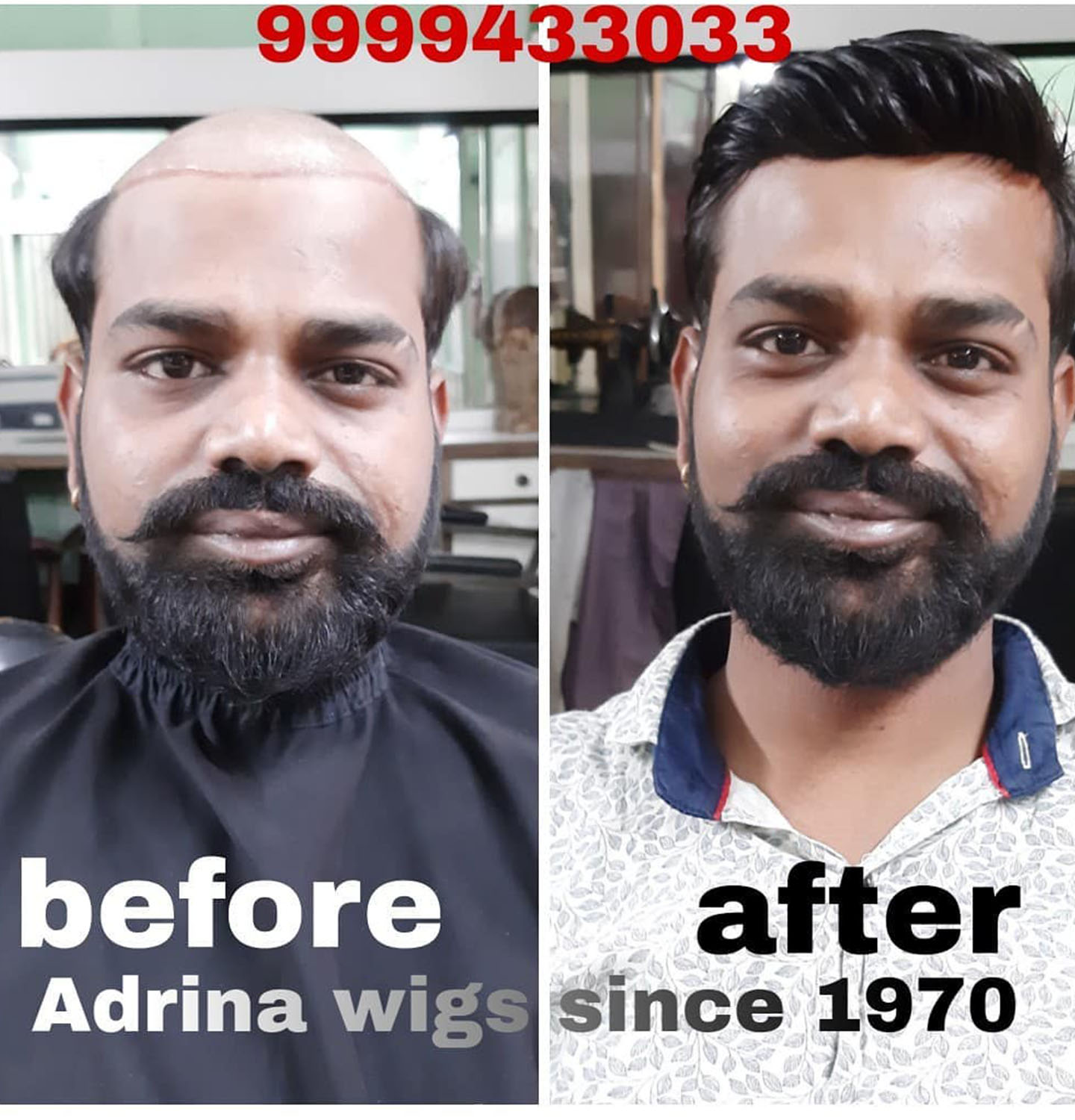 Hair Studio in Bhopal GanjBhilwara  Best Hair Transplant Clinics in  Bhilwara  Justdial